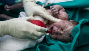 Maternidade terá de indenizar por sumiço de placenta de paciente que perdeu o bebê